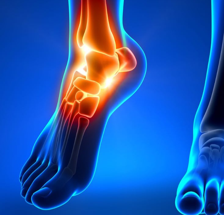Heel Pain