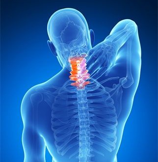 Spondylosis