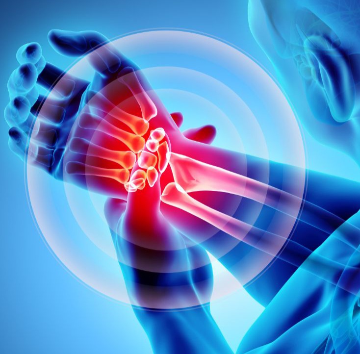 Wrist Pain